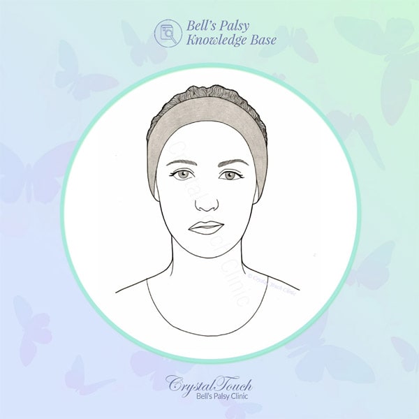 Difference between facial palsy and Bell's palsy