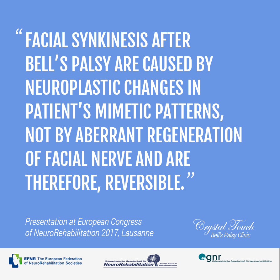 Bell's palsy, presentation at ECNR 2017
