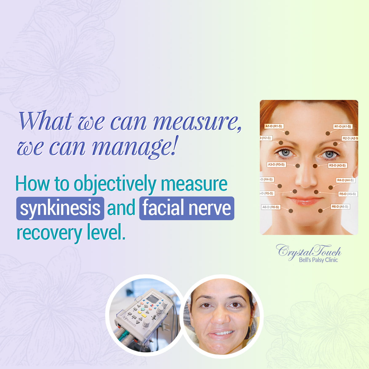 Measuring synkinesis and facial nerve recovery level