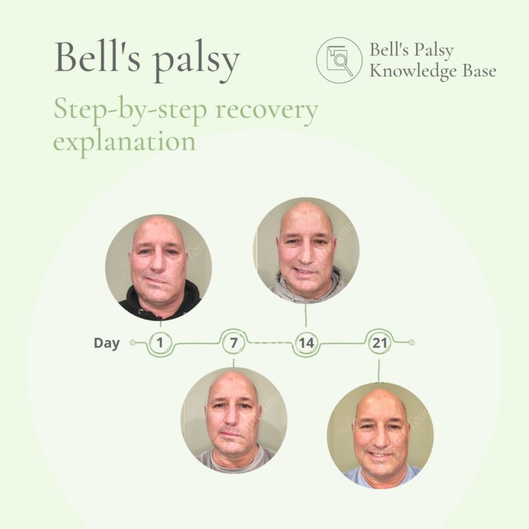 Step-by-step Bell's palsy recovery explanation