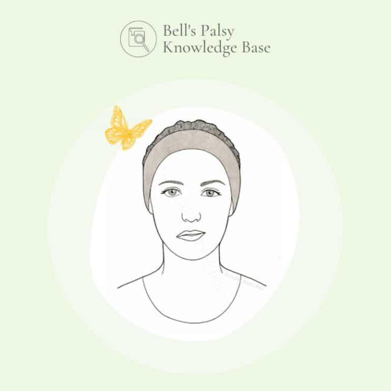 A poster with a face with Bell's palsy, text reads "What is Bell's palsy?"