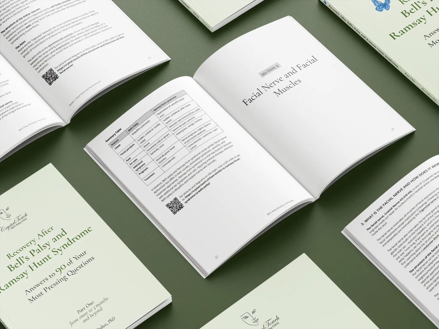 Sample page from Bell's Palsy and Ramsay Hunt Syndrome recovery book showing open pages of the book